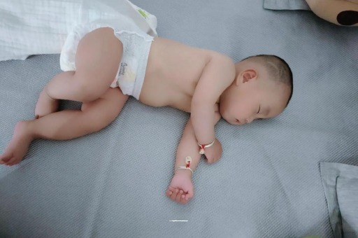 伊犁宝宝头上长痱子